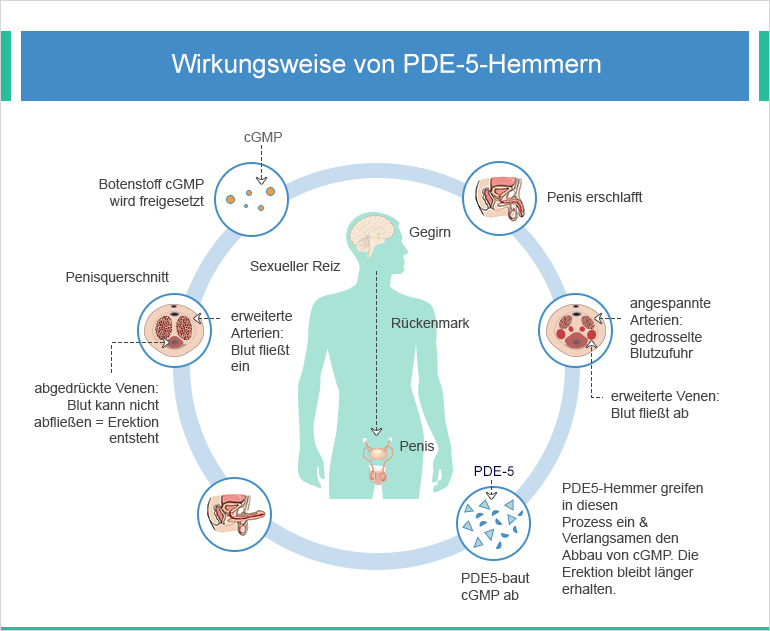 Phallosan Forte: Übersicht, Kosten, Erfahrung, Ursachen, Behandlung, PDE5-Hemmer