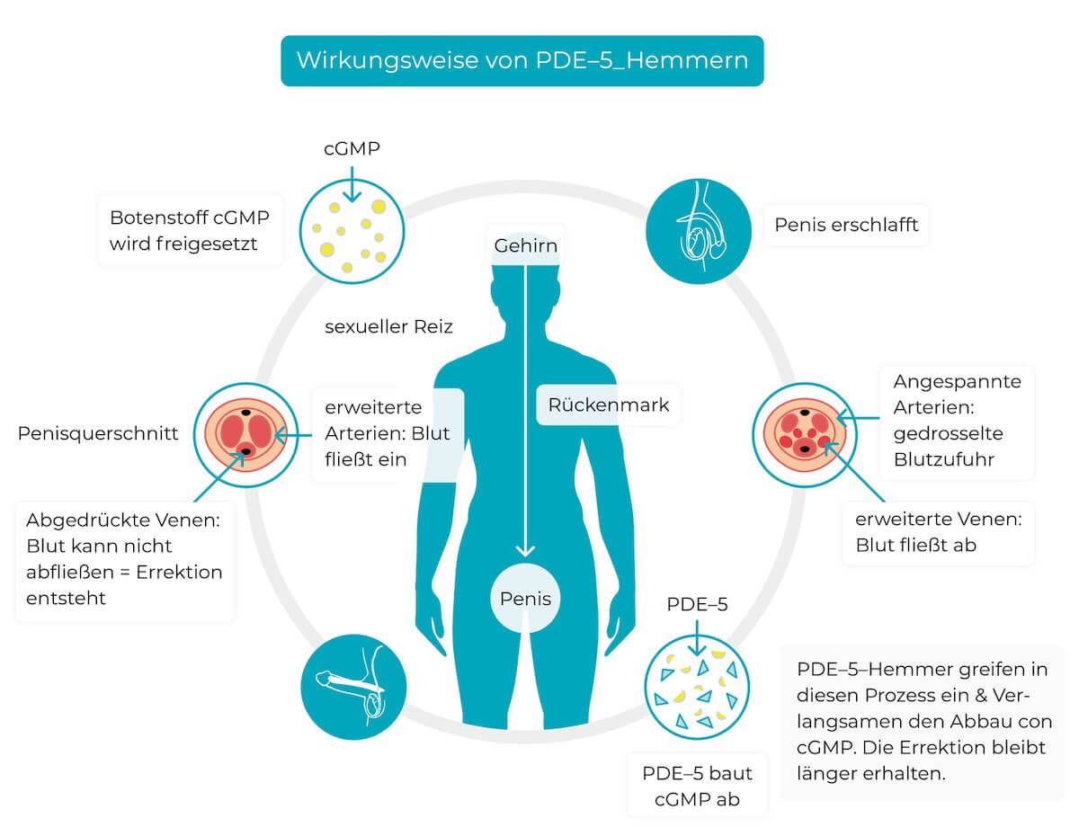 Erektionsstörungen behandeln, PDE5-Hemmer, Cialis und Viagra Generika